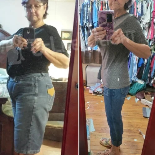 Weight Loss With Gastric Sleeve Surgery Pam S - 4 Year Update*